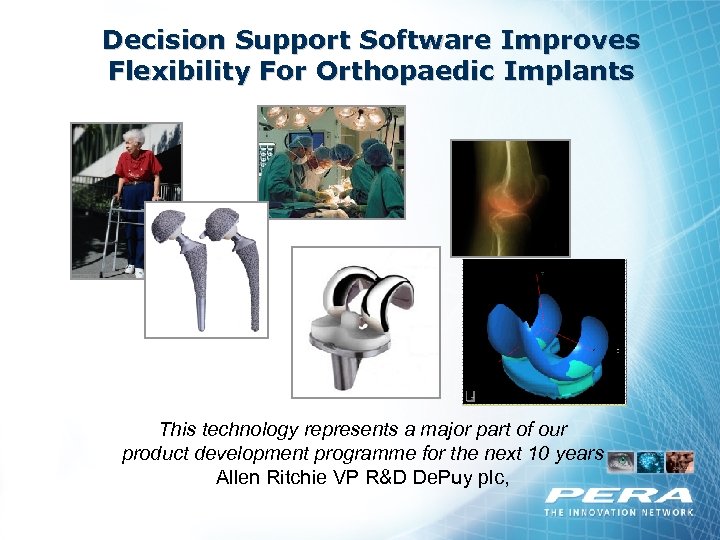 Decision Support Software Improves Flexibility For Orthopaedic Implants This technology represents a major part