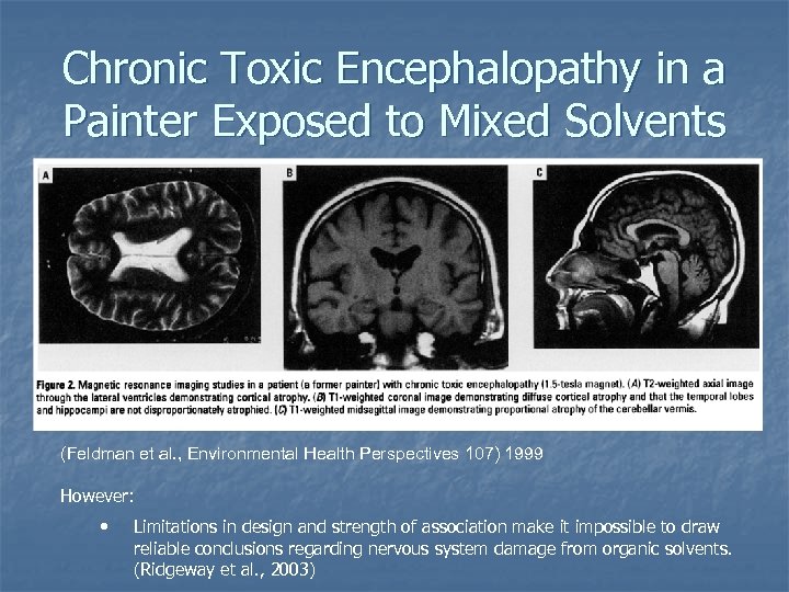 Chronic Toxic Encephalopathy in a Painter Exposed to Mixed Solvents (Feldman et al. ,