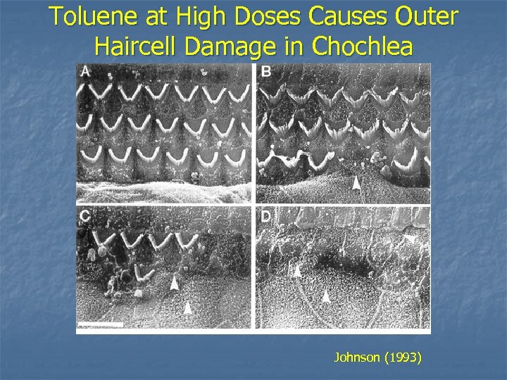 Toluene at High Doses Causes Outer Haircell Damage in Chochlea Johnson (1993) 