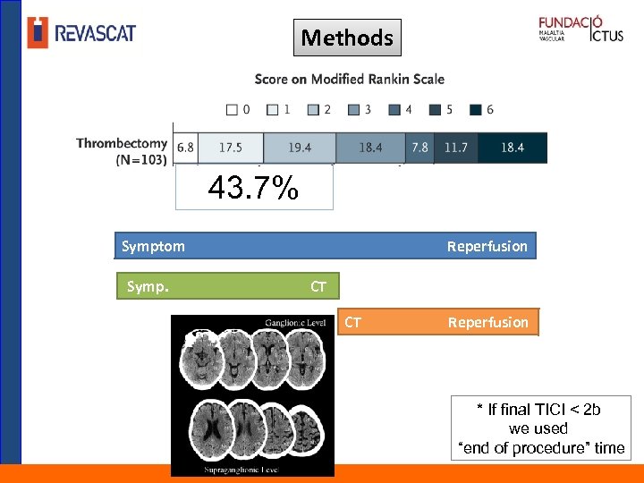 Methods 43. 7% Symptom Symp. Reperfusion CT CT Reperfusion * If final TICI <