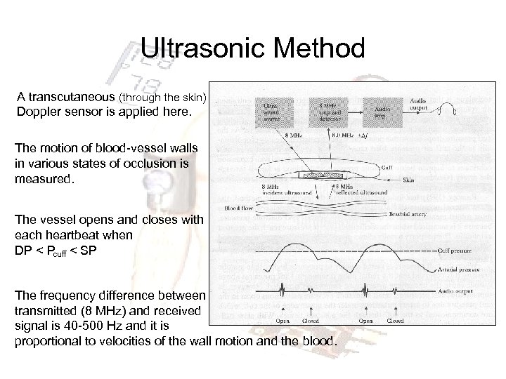 Ultrasonic Method A transcutaneous (through the skin) Doppler sensor is applied here. The motion