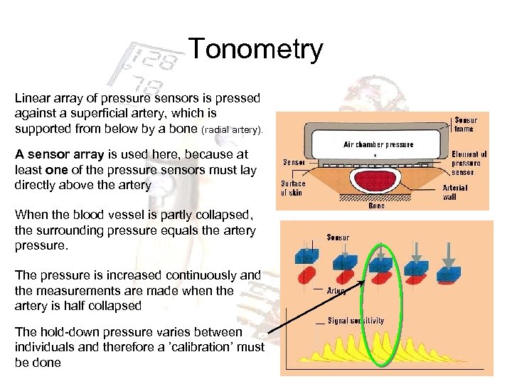 Tonometry Linear array of pressure sensors is pressed against a superficial artery, which is