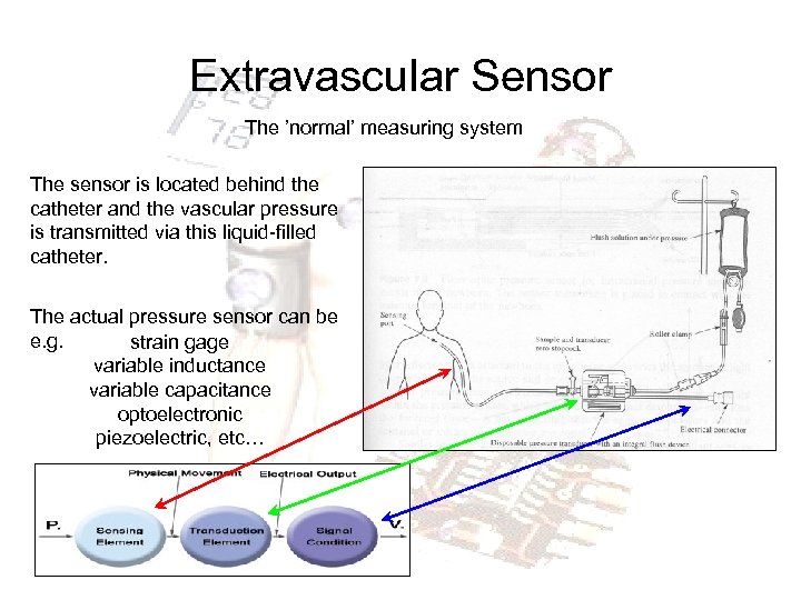 Extravascular Sensor The ’normal’ measuring system The sensor is located behind the catheter and
