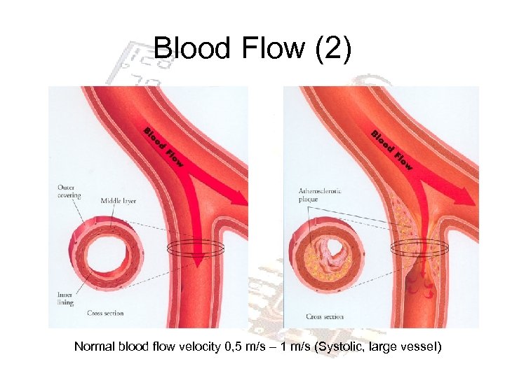 Blood Flow (2) Normal blood flow velocity 0, 5 m/s – 1 m/s (Systolic,