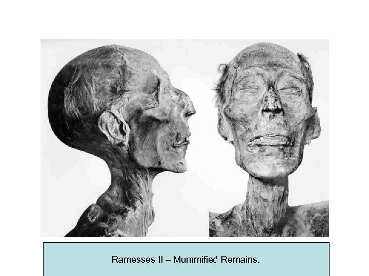 Ramesses II – Mummified Remains. 