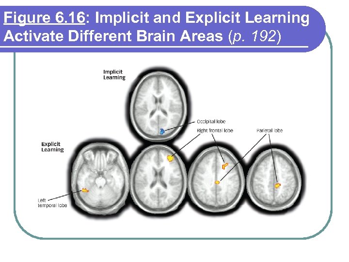 Figure 6. 16: Implicit and Explicit Learning Activate Different Brain Areas (p. 192) 