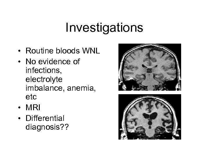 Investigations • Routine bloods WNL • No evidence of infections, electrolyte imbalance, anemia, etc