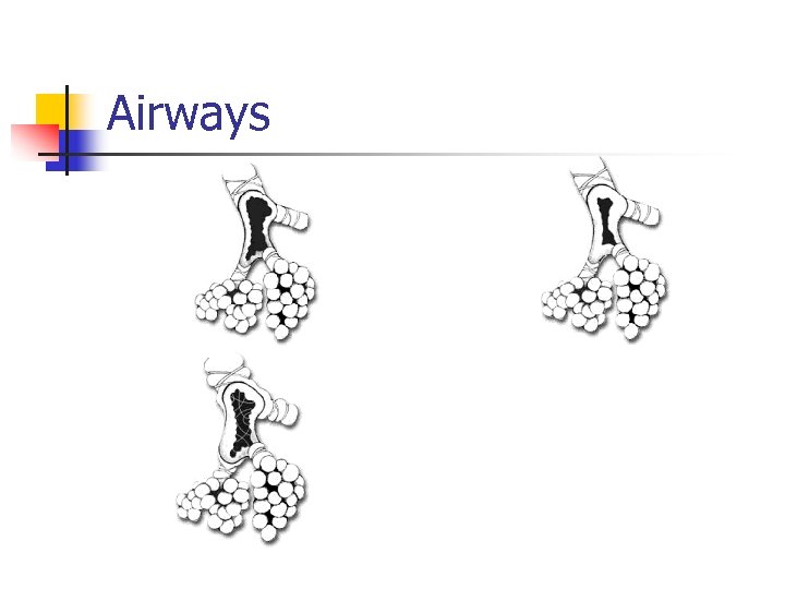 Airways 