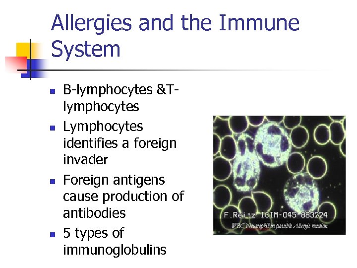 Allergies and the Immune System n n B-lymphocytes &Tlymphocytes Lymphocytes identifies a foreign invader