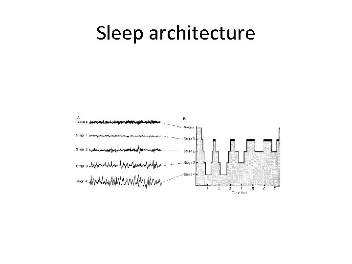 Sleep architecture 