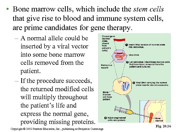  • Bone marrow cells, which include the stem cells that give rise to