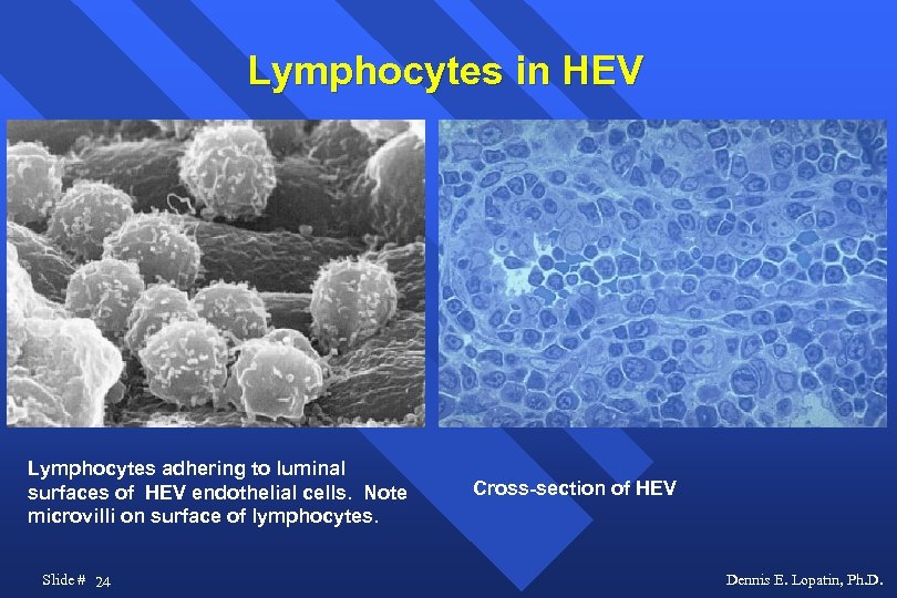 Lymphocytes in HEV Lymphocytes adhering to luminal surfaces of HEV endothelial cells. Note microvilli