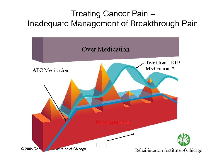 Treating Cancer Pain – Inadequate Management of Breakthrough Pain Over Medication Traditional BTP Medications*