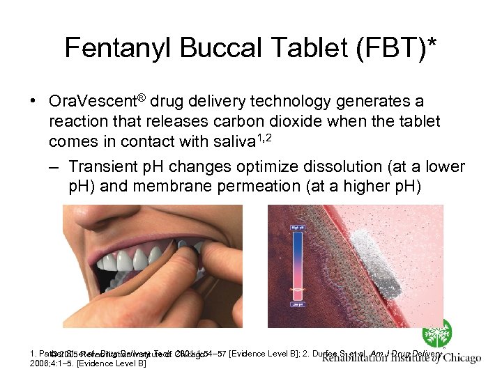 Fentanyl Buccal Tablet (FBT)* • Ora. Vescent® drug delivery technology generates a reaction that