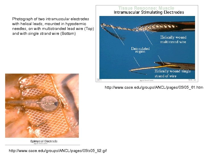 Photograph of two intramuscular electrodes with helical leads, mounted in hypodermic needles, on with