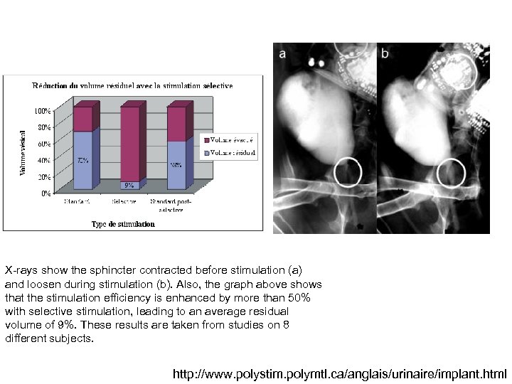 X-rays show the sphincter contracted before stimulation (a) and loosen during stimulation (b). Also,