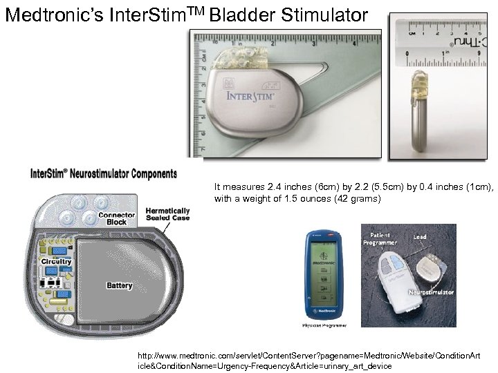 Medtronic’s Inter. Stim. TM Bladder Stimulator It measures 2. 4 inches (6 cm) by