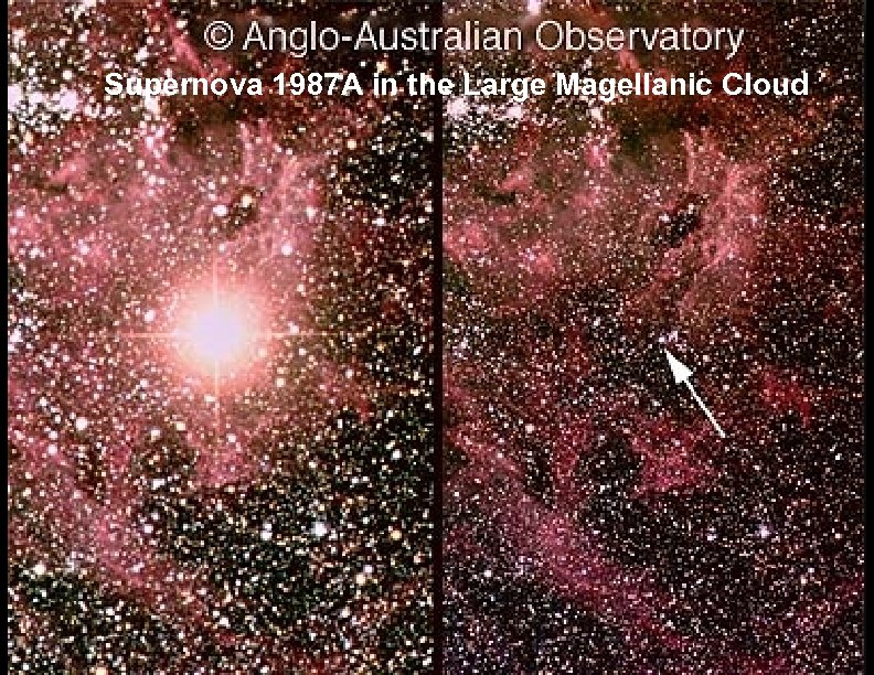 Supernova 1987 A in the Large Magellanic Cloud 