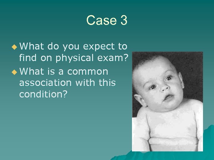 Case 3 u What do you expect to find on physical exam? u What
