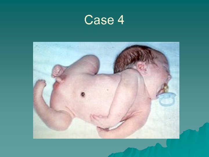 Case 4 
