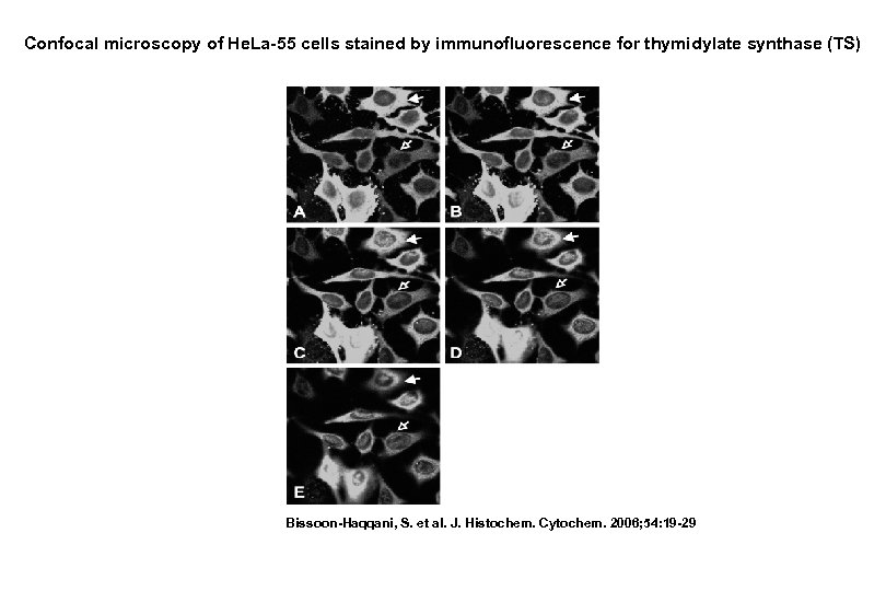 Confocal microscopy of He. La-55 cells stained by immunofluorescence for thymidylate synthase (TS) Bissoon-Haqqani,