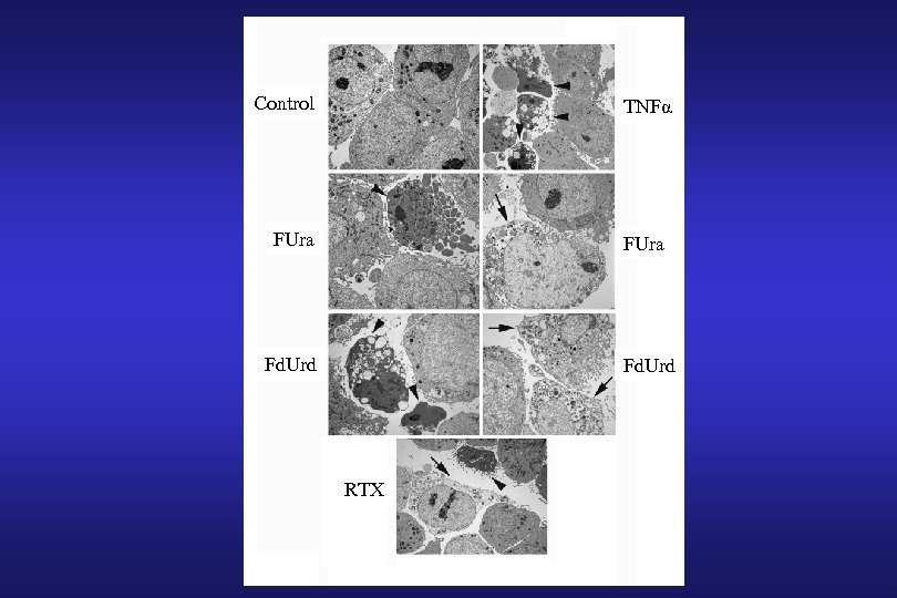 Control TNFα FUra Fd. Urd RTX 