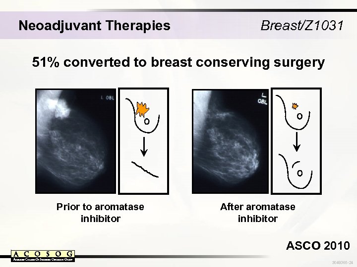 Neoadjuvant Therapies Breast/Z 1031 51% converted to breast conserving surgery Prior to aromatase inhibitor