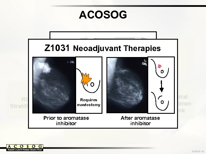 ACOSOG Z 1031 Individualized Response Monitoring Neoadjuvant Therapies Z 6051 Risk Stratification Requires mastectomy