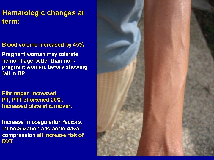 Hematologic changes at term: Blood volume increased by 45% Pregnant woman may tolerate hemorrhage