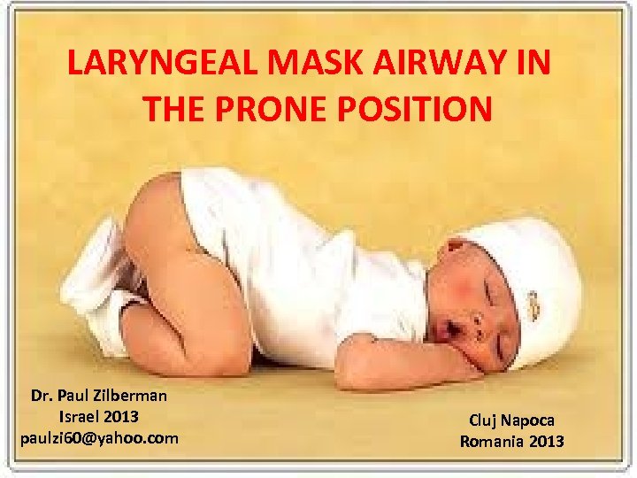 LARYNGEAL MASK AIRWAY IN THE PRONE POSITION Dr. Paul Zilberman Israel 2013 paulzi 60@yahoo.
