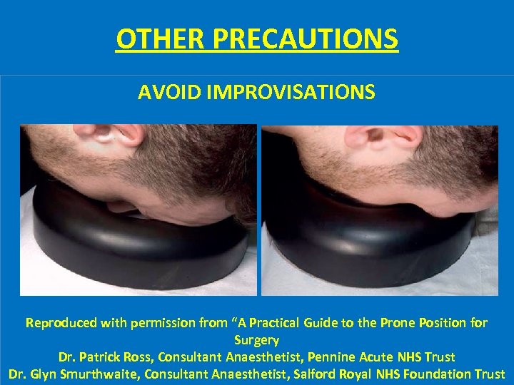 OTHER PRECAUTIONS AVOID IMPROVISATIONS Reproduced with permission from “A Practical Guide to the Prone