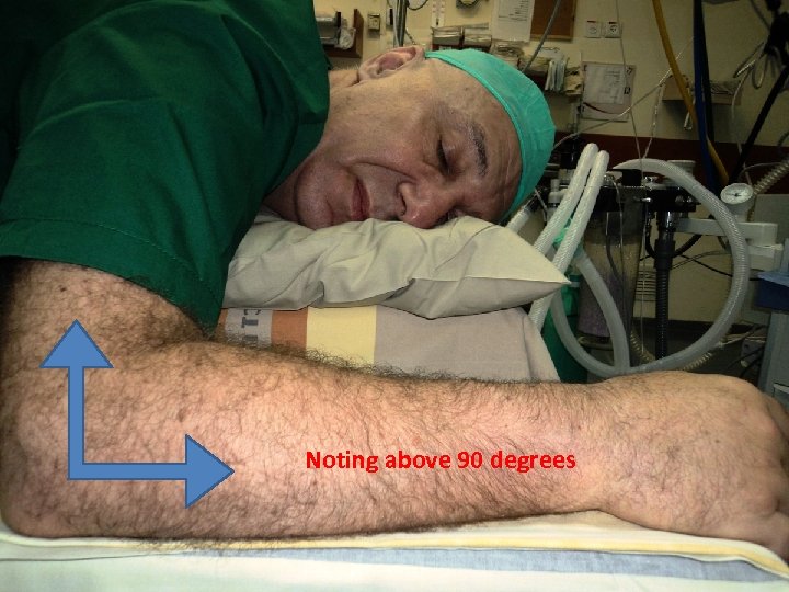 Noting above 90 degrees 