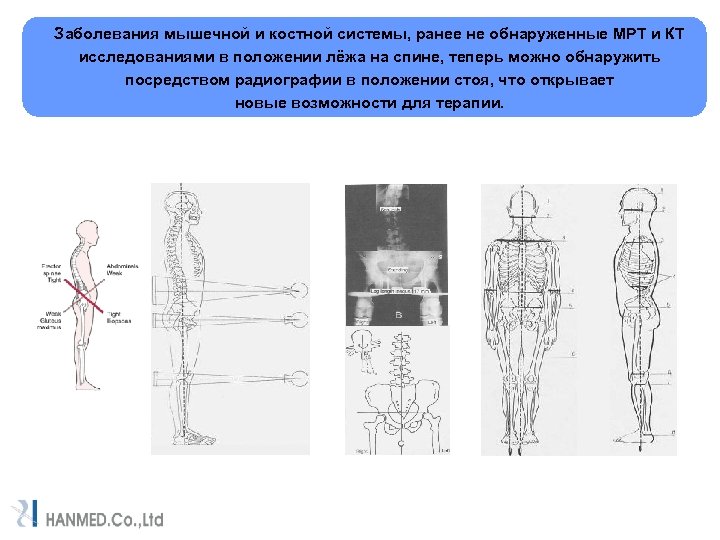 Заболевания мышечной и костной системы, ранее не обнаруженные МРТ и КТ исследованиями в положении