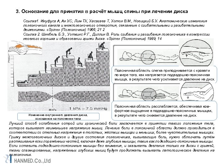 3. Основание для принятия в расчёт мышц спины при лечении диска Ссылка 1. Инуфуса