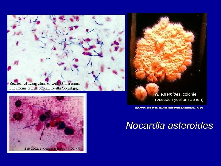 Section of Lung stained with Gram stain. http: //home. primus. com. au/royellis/nocast. jpg N.