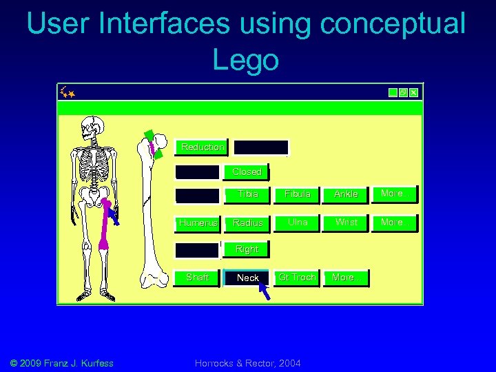 User Interfaces using conceptual Lego Reduction Fixation Open Femur Tibia Fibula Ankle More. .