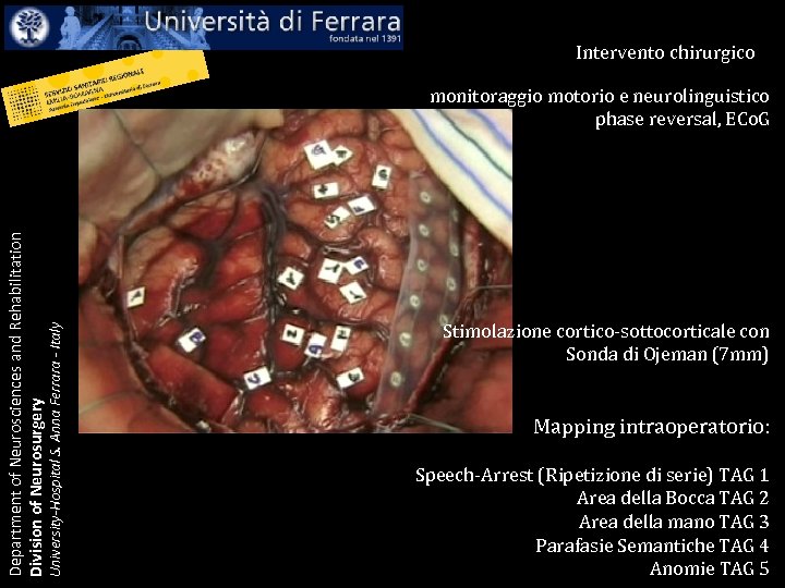 Intervento chirurgico University-Hospital S. Anna Ferrara - Italy Department of Neurosciences and Rehabilitation Division