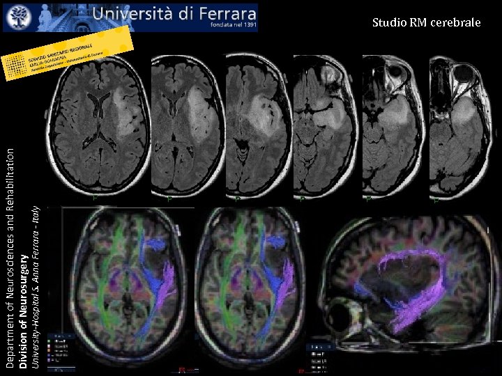 University-Hospital S. Anna Ferrara - Italy Department of Neurosciences and Rehabilitation Division of Neurosurgery