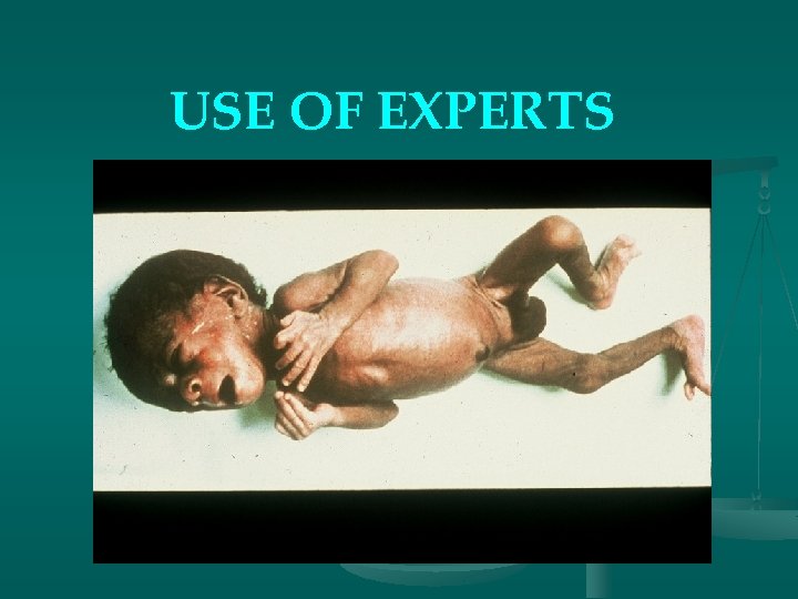 USE OF EXPERTS 