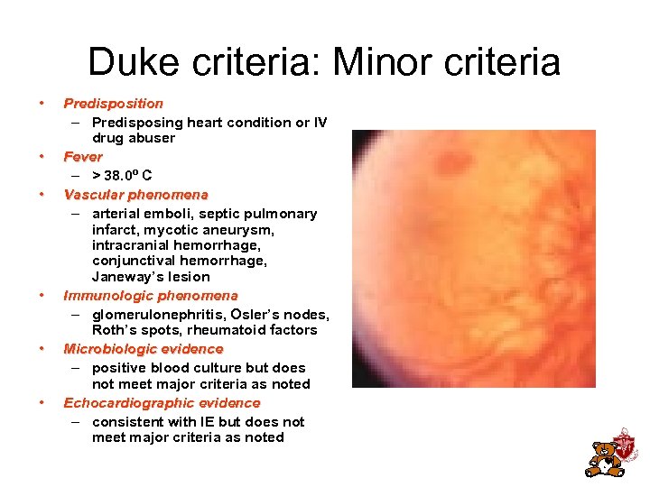 Duke criteria: Minor criteria • • • Predisposition – Predisposing heart condition or IV
