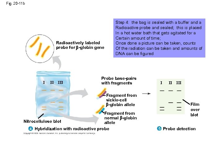 Fig. 20 -11 b Radioactively labeled probe for -globin gene I II III Step