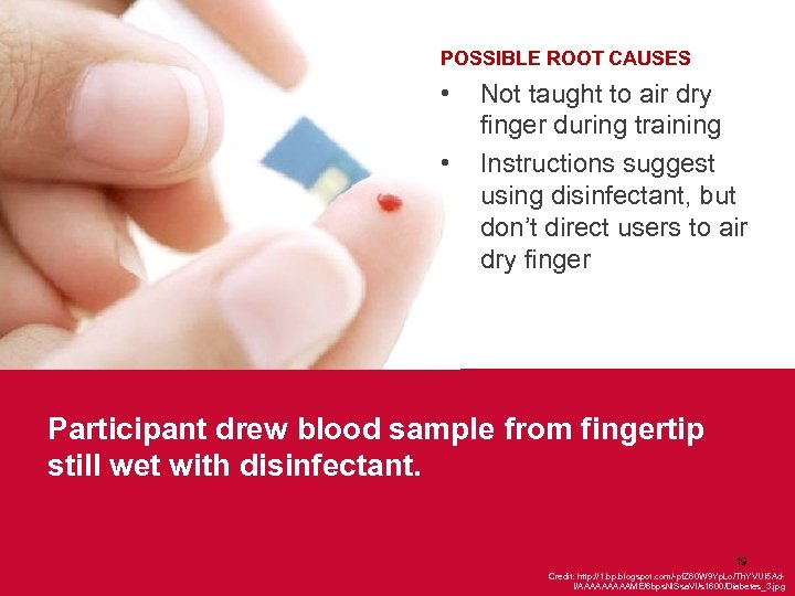 POSSIBLE ROOT CAUSES • • Not taught to air dry finger during training Instructions