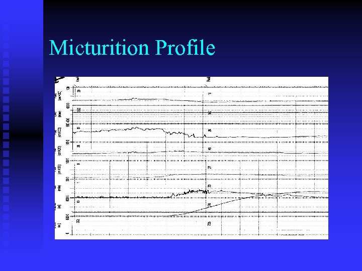 Micturition Profile 