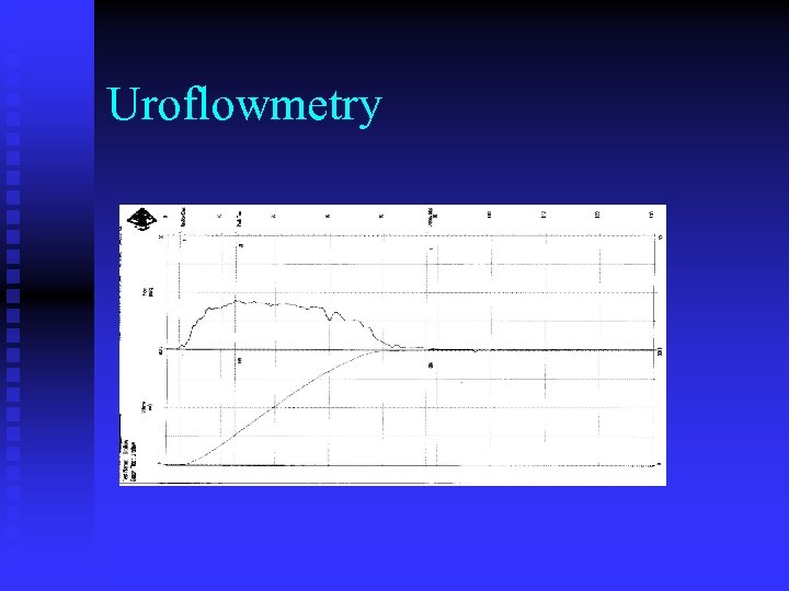 Uroflowmetry 