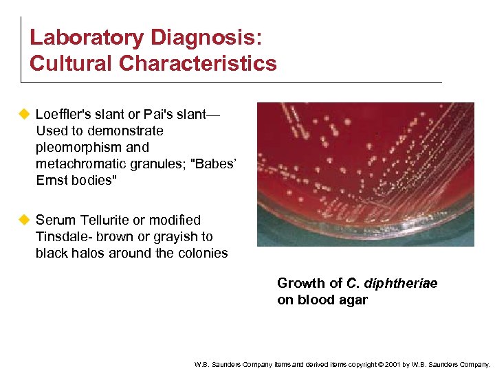 Laboratory Diagnosis: Cultural Characteristics u Loeffler's slant or Pai's slant— Used to demonstrate pleomorphism