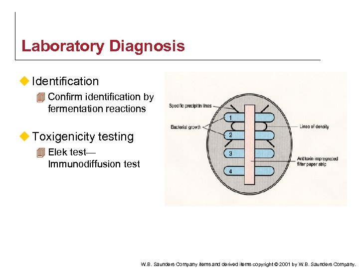 Laboratory Diagnosis u Identification 4 Confirm identification by fermentation reactions u Toxigenicity testing 4