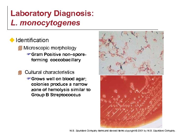 Laboratory Diagnosis: L. monocytogenes u Identification 4 Microscopic morphology F Gram Positive non–sporeforming coccobacillary