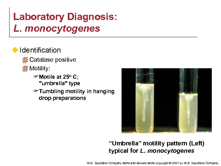 Laboratory Diagnosis: L. monocytogenes u Identification 4 Catalase positive 4 Motility: F Motile at