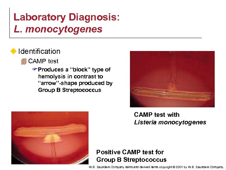 Laboratory Diagnosis: L. monocytogenes u Identification 4 CAMP test F Produces a “block” type