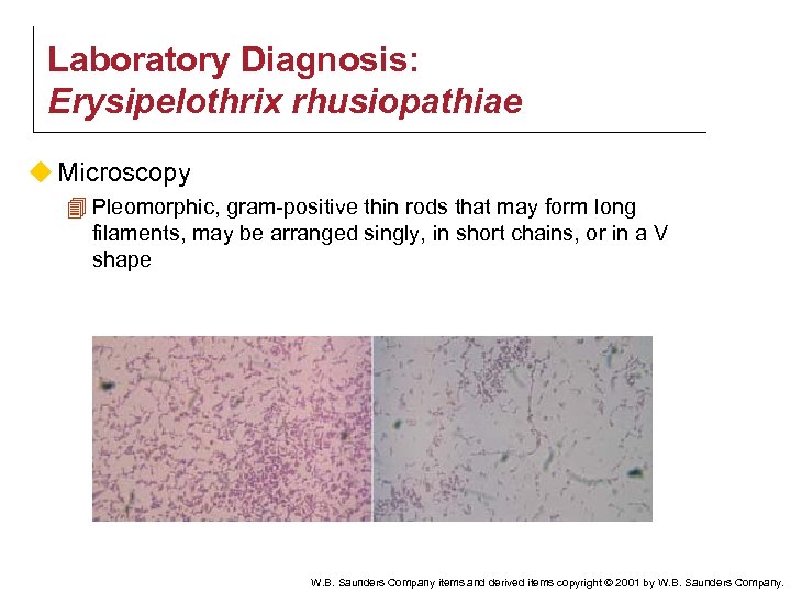 Laboratory Diagnosis: Erysipelothrix rhusiopathiae u Microscopy 4 Pleomorphic, gram-positive thin rods that may form